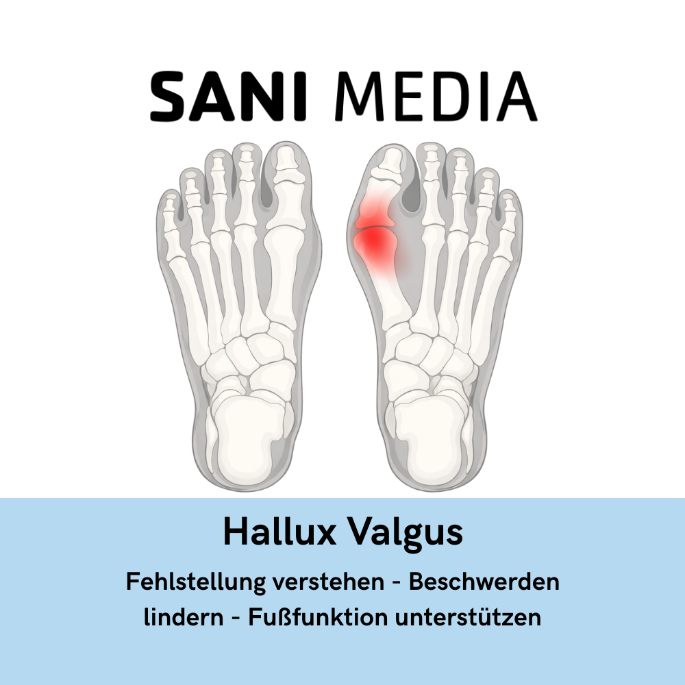 Patientenflyer Hallux Valgus zur Aufklärung über Großzehenfehlstellung, Symptome und konservative Maßnahmen für Sanitätshaus und Orthopädieschuhtechnik